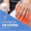 인공관절 수술병원 서재곤링커병원의 무릎 인공관절 수술 효과는? 이미지