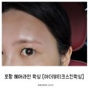 포항왁싱 [아더뷰티크스킨왁싱] / 헤어라인왁싱 후기