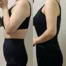 대구농산(주)인천지점 | 수원지방분해주사 3주간 5kg 감량 내돈내산 후기