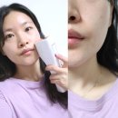 (주)하이로닉 | 리프팅기기 홈쎄라 디바이스 심부볼 2주 관리 후기