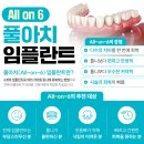 안면기공소 이미지