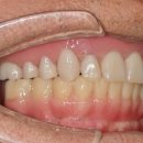 On(온)치과기공소 이미지