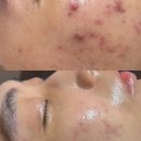 뷰티연 네이버블로그