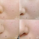 아쿠아인뷰티 | [이너비] 아쿠아 인앤온 / innerb aqua in & on / 먹는 화장품 /이너뷰티