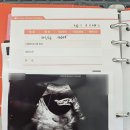 고은여성병원 | 밤중에 병원에 다녀온 날, 아이들이 조금 자란 것 같았다