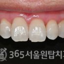 원탑 치과기공소 이미지