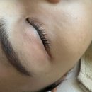 아차산약국 | 아차산 피부관리 바나나부띠끄 듀얼 리프팅 만족 후기