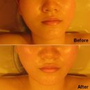 경락마사지 이미지