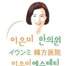 &lt;조기폐경&gt; 조기폐경의 진단, 치료 이미지