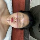 삼안로291번길L | 이천리프팅 이중턱 없이 브이라인 완성 더라푼 수기 L커브 리프팅 리얼후기