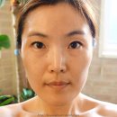 올가휴 수원점 | 웨딩케어 뾰루지 가라앉히기 - 건대 자양동 올가휴 피부관리