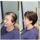 머리숱없는 50, 60대 여성 혼주가발 딸 결혼식을 위한 맞춤가이드 강남 여자가발