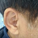 대전보장구센터 | 대전 대동역 보청기 만족 후기
