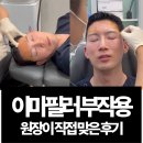 홍대피부과 이마필러 부작용, 원장이 직접 맞은 후기 부기 부작용?