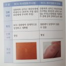 송파우리들의원 네이버블로그