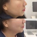 에코메디칼 | 전주피부관리 전주에코시티피부관리 전주송천동피부관리 전주 스킨플라청담