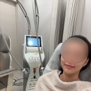 닥터쁘띠의원마곡점 | 온다 리프팅 후기 - 건대피부과 건대닥터쁘띠의원 온다 리프팅 레이저 효과 리뷰