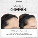 공덕두피문신 탈모 치료, 뭐가 제일 나을까?