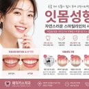 잇몸성형, 짧아 보이는 앞니와 잇몸 라인이 고민이라면? 매직키스치과﻿ 이미지