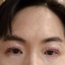 마침표성형외과의원 네이버블로그