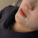 리프톤피부과의원 | 신사 리프톤 피부과 의원 &#39;티타늄 리프팅&#39; 솔직 후기 | 80JK | 팔자주름 직빵