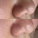 1004 약국 | 야당역 피부관리 잡티관리 쥐젖관리후기 SA왁싱&amp;스킨케어