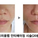 The 예쁜 피부