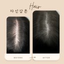 수원 두피문신 수강 대한민국 최고 시설, 안산 담타투 두피문신 아카데미 솔직 후기