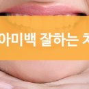 조은미소치과 이미지