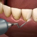 본정치과의원 이미지