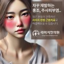 부산주사피부염 뿐만 아니라 안면홍조까지 근원치료로 다잡는 이곳 이미지