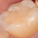 메디포레치과의원 이미지