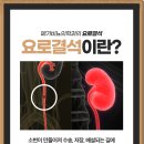 메가비뇨의학과 이미지