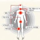 폐암 초기 말기 증상 1기~4기 치료 방법은? 이미지