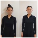 지성약국 | 범계얼굴비대칭 두골비 플로라스킨케어 안양두골비 관리 후기