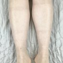 국가대표 꽈배기 | [포그로스 체형교정 &amp; 재활운동 &amp; 필라테스 &amp; PT 선릉점] 솔직 후기