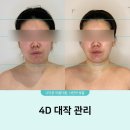 창원 피부관리 ㅣ [고운빛깔에스테틱 창원본점] 4d대작관리 솔직후기