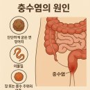 전주병원 맹장수술 후기 초기증상 통증 입원기간