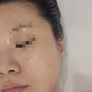 수라움에스떼 | 신촌 에스테틱 수라움에스떼 신촌역 피부관리 후기