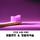 세브란스치과 티스토리