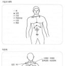 피를 맑게하는 몸통 부항 뜨는 법 이미지