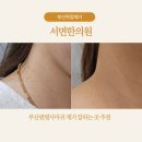 바로서면병원 | 부산편평사마귀, 부산쥐젖 제거 서면 한의원 다녀온 솔직후기