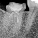 더바른윤치과의원 이미지