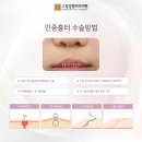 그림성형외과의원 이미지