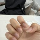 네일스토니