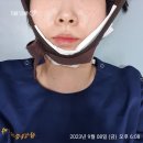 범계 도수치료+충격파 치료 후기(23.09)