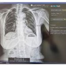 광주본튼튼365의원 이미지