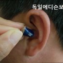 독일에디슨보청기