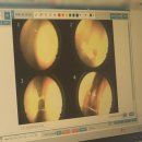 생명한의원 | 축농증 증상 지속된 코막힘으로 찾은 한의원 축농증 치료 후기