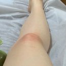 UR(경산시)-[장산로]-하-4 | [경산에스테틱] 김미주스킨케어 | 절대 안 빠지던 허벅지살, 하체관리 받은 후기 (셀룰라이트관리...